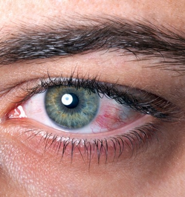 L Oeil Rouge L Oeil Rouge