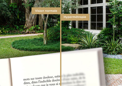 Image décrivant à gauche une vision normale et à droite une vision avec hypermétropie Image décrivant à gauche une vision normale et à droite une vision avec hypermétropie