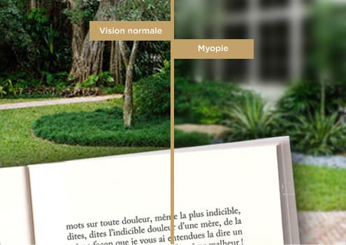 Image décrivant à gauche une vision normale et à droite une vision avec myopie Image décrivant à gauche une vision normale et à droite une vision avec myopie