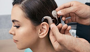 definition-implant-cochleaire